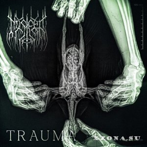 Nos&#322;eep - Trauma (2025)