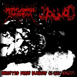 Histoplasmosislymphostasis / DRUNAD - Infected Brain Surgery (Split) (2025)